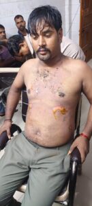 लोन की किस्त वसूली कर लौट रहे बैक मैनेजर और कर्मचारी पर गिरी आकाशीय बिजली,दोनों हुए घायल 12 IMG 20260701 WA0051