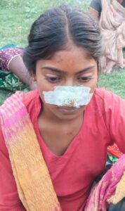 मायके जाने के विवाद में खूनी बवाल: पति ने पत्नी की नाक काटी, जवाब में ससुराल पहुंचे मायके पक्ष ने ननद की नाक काटी 14 IMG 20260711 WA0019