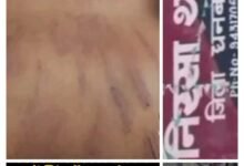 नवोदय विद्यालय की सुरक्षा पर लगा बड़ा धब्बा, छात्र को निर्वस्त्र कर बेल्ट से पीटा, वीडियो वायरल; होगी कार्रवाई या सोती रहेगी धनबाद पुलिस? 37 IMG 20260717 WA0151