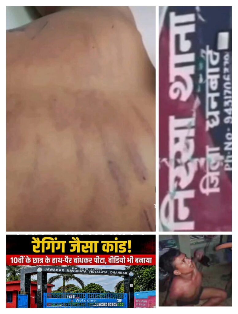 नवोदय विद्यालय की सुरक्षा पर लगा बड़ा धब्बा, छात्र को निर्वस्त्र कर बेल्ट से पीटा, वीडियो वायरल; होगी कार्रवाई या सोती रहेगी धनबाद पुलिस? 1 IMG 20260717 WA0151