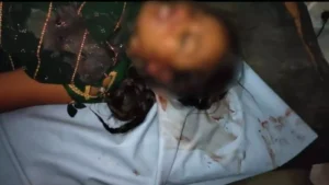 2255347 sleemanabad accident woman hospitaljpg 2