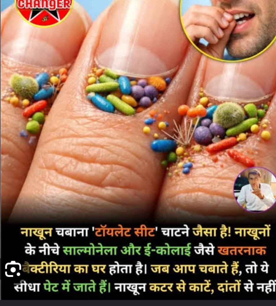 नाखून चबाना हमेशा केवल एक बुरी आदत नहीं होता। कई बार यह शरीर का संकेत होता है कि व्यक्ति मानसिक तनाव, चिंता या भावनात्मक दबाव से गुजर रहा है। यदि यह आदत लंबे समय तक बनी रहे, नुकसान पहुंचाने लगे या व्यक्ति के नियंत्रण से बाहर हो जाए, तो इसे नजरअंदाज करने के बजाय समय रहते विशेषज्ञ से सलाह लेना बेहतर होता है। 3 IMG 20260803 WA0251