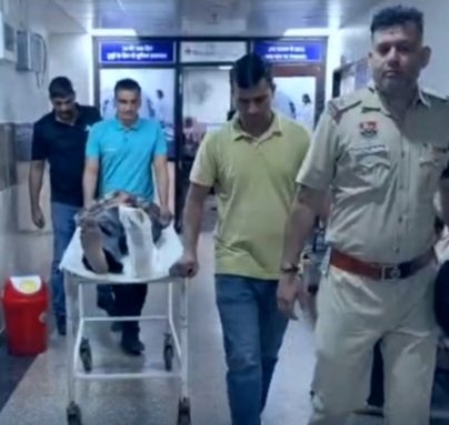 पुलिस कस्टडी से भाग रहे आरोपी की टूटी टांग।