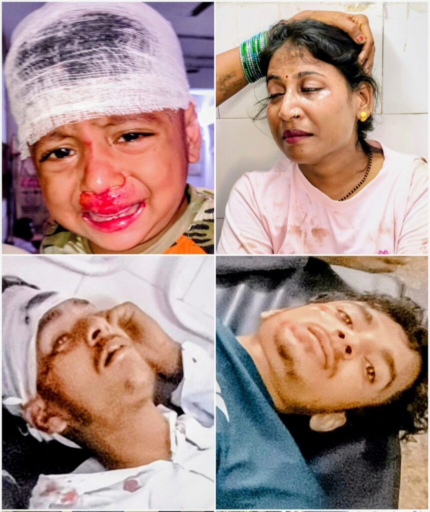 कांठ में कार ने बाइक में मारी टक्कर, 14 माह के बच्चे समेत चार घायल