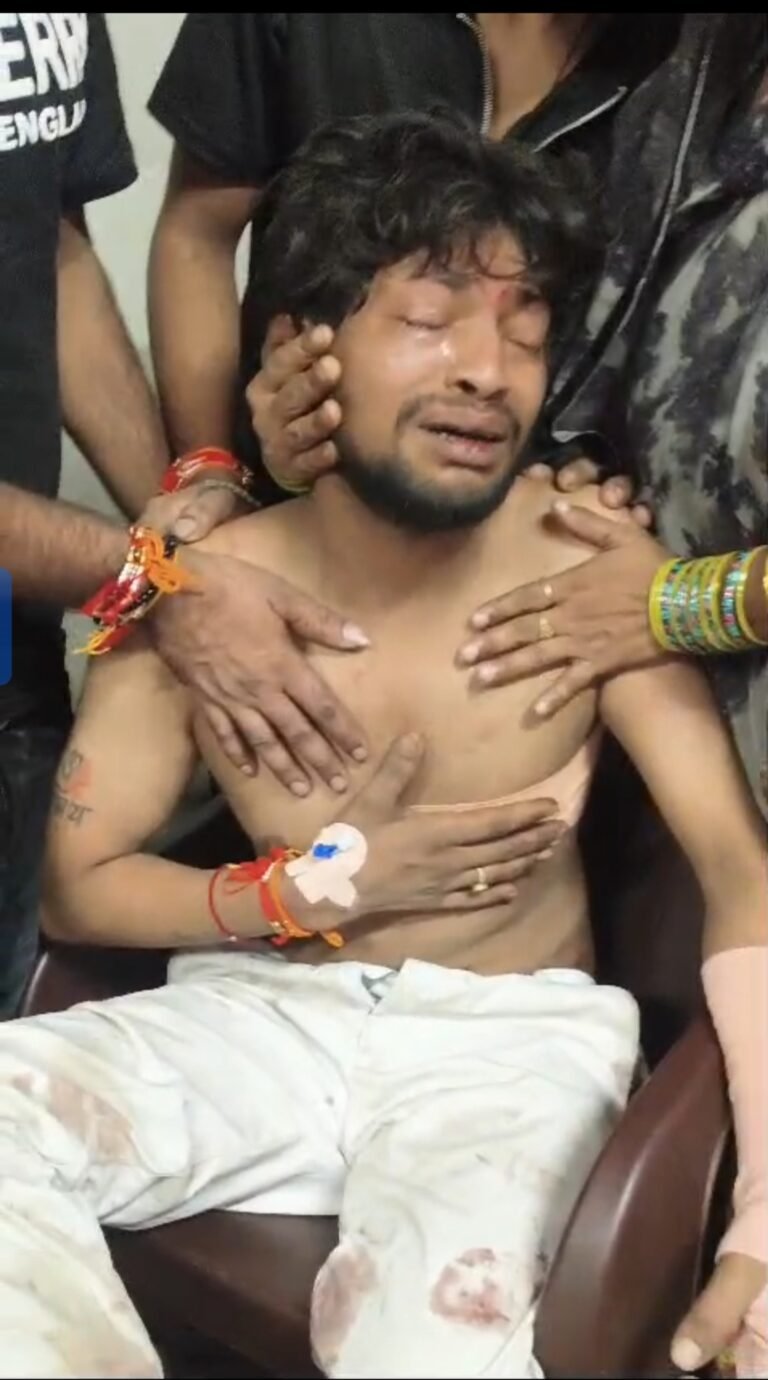 देवरी रोड पर मोमोज खाने गए युवक को कार में डालकर बेसमेंट में ले गए दबंग सरिया-हॉकी से पीटा 9 हजार और मोबाइल लूटा