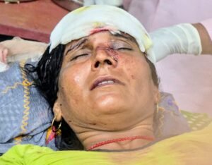 कांठ के भरतपुर में घास काट रही महिला पर तेंदुए ने किया हमला, महिला गंभीर घायल, अस्पताल में कराया भर्ती 3 IMG 20260915 WA01382