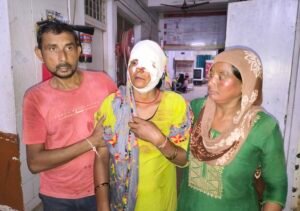 कांठ के भरतपुर में घास काट रही महिला पर तेंदुए ने किया हमला, महिला गंभीर घायल, अस्पताल में कराया भर्ती 4 IMG 20260915 195245455 BURST000 COVER TOP2