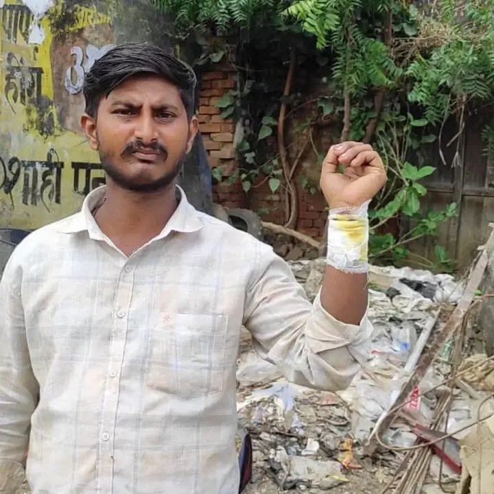 कप्तानगंज में दिनदहाड़े चाकूबाजी, दुकानदार पिता-पुत्र घायल