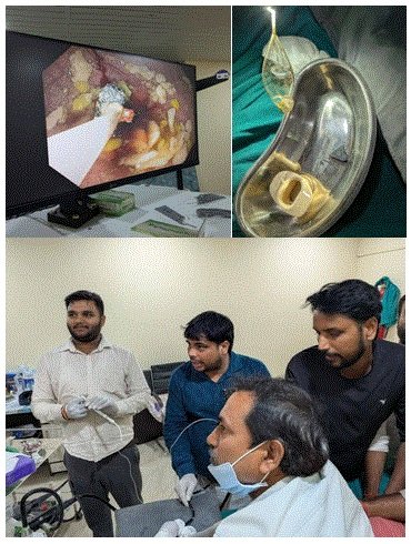 T.N. Memorial Hospital, Basti में बिना ऑपरेशन बच्चे के पेट से निकाला गया चुंबक!