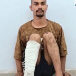 कोटा में चाकू दिखाकर सर्राफा व्यापारी से लूट, 21 साल के आरोपी पर 20 मुकदमे दर्ज