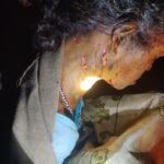 तेंदुआ ने बर्तन धो रही महिला पर किया अटैक
