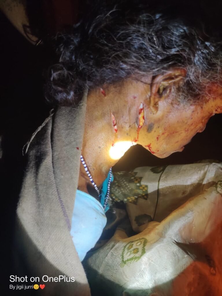 तेंदुआ ने बर्तन धो रही महिला पर किया अटैक