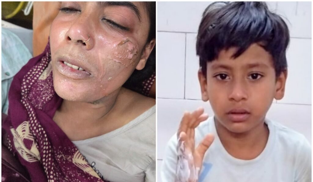 कांठ के ईदगाह नईवस्ती लटकी हाईटेंशन लाइन बनी हादसे की वजह, बुआ-भतीजा झुलसे - MORADABAD, उत्तर प्रदेश