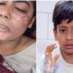 कांठ के ईदगाह नईवस्ती लटकी हाईटेंशन लाइन बनी हादसे की वजह, बुआ-भतीजा झुलसे