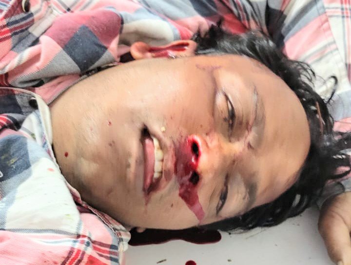 हादसा: पेड़ से बाइक टकराई चालक की मौत, मचा कोहराम 1 हादसा: पेड़ से बाइक टकराई चालक की मौत, मचा कोहराम - MORADABAD, उत्तर प्रदेश