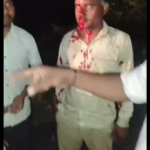 एटा में बाइक सवार नितेश गंभीर रूप से घायल, 108 एंबुलेंस ने बचाई जान