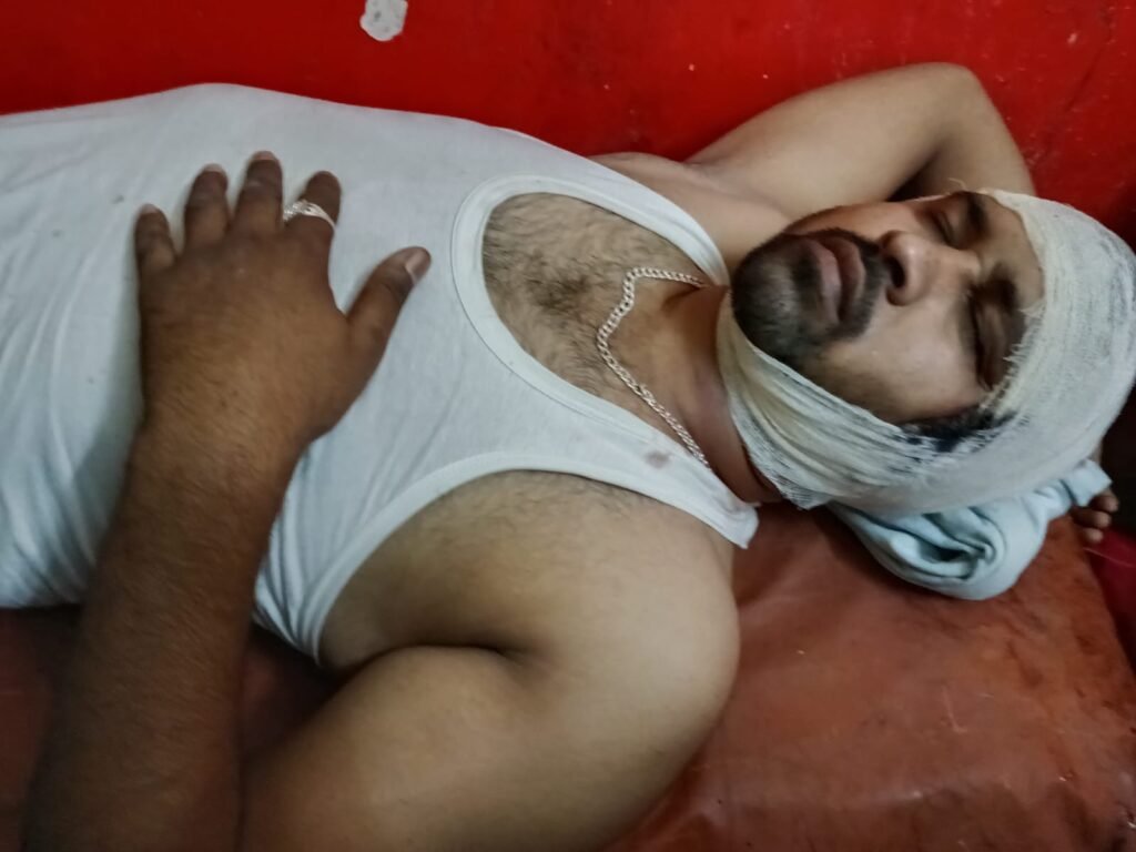बरखुरदार पुर के 2 युवक घायल सड़क पर पलट गई चार पहिया - RAE BARELI, उत्तर प्रदेश