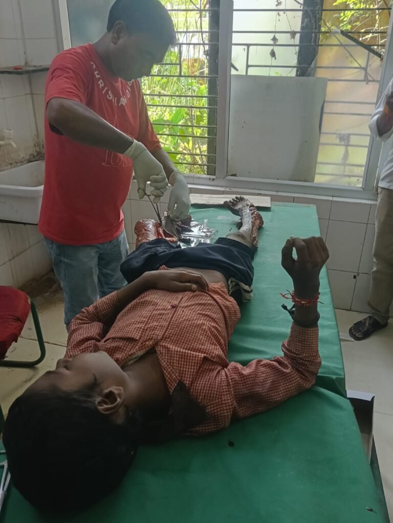 साइकिल सवार 7 वर्षीय बच्चा हुआ घायल!