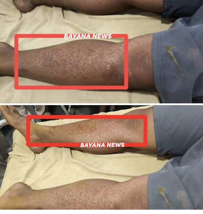 गांव में आपसी फायरिंग से मचा हड़कंप