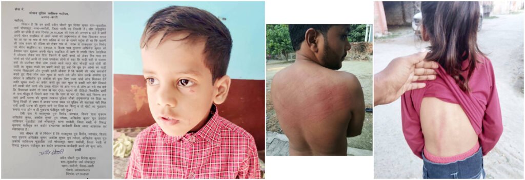 सूचना अधिकार से जानकारी मांगा तो प्रधान के भतीजे सहित कई लोगो ने पुरानी रंजिश को लेकर मारा पीटा पीड़ित ने डीएम, एसपी से लगाया न्याय की गुहार । - BASTI, उत्तर प्रदेश