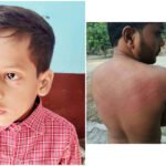 सूचना अधिकार से जानकारी मांगा तो प्रधान के भतीजे सहित कई लोगो ने पुरानी रंजिश को लेकर मारा पीटा पीड़ित ने डीएम, एसपी से लगाया न्याय की गुहार ।